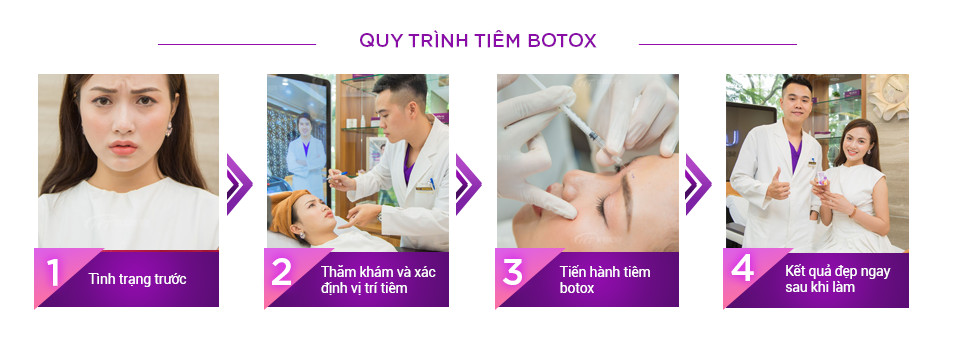 Quy trình tiêm botox tại Thẩm mỹ Hoàng Tuấn